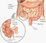 ดีท็อกล้างลำไส้